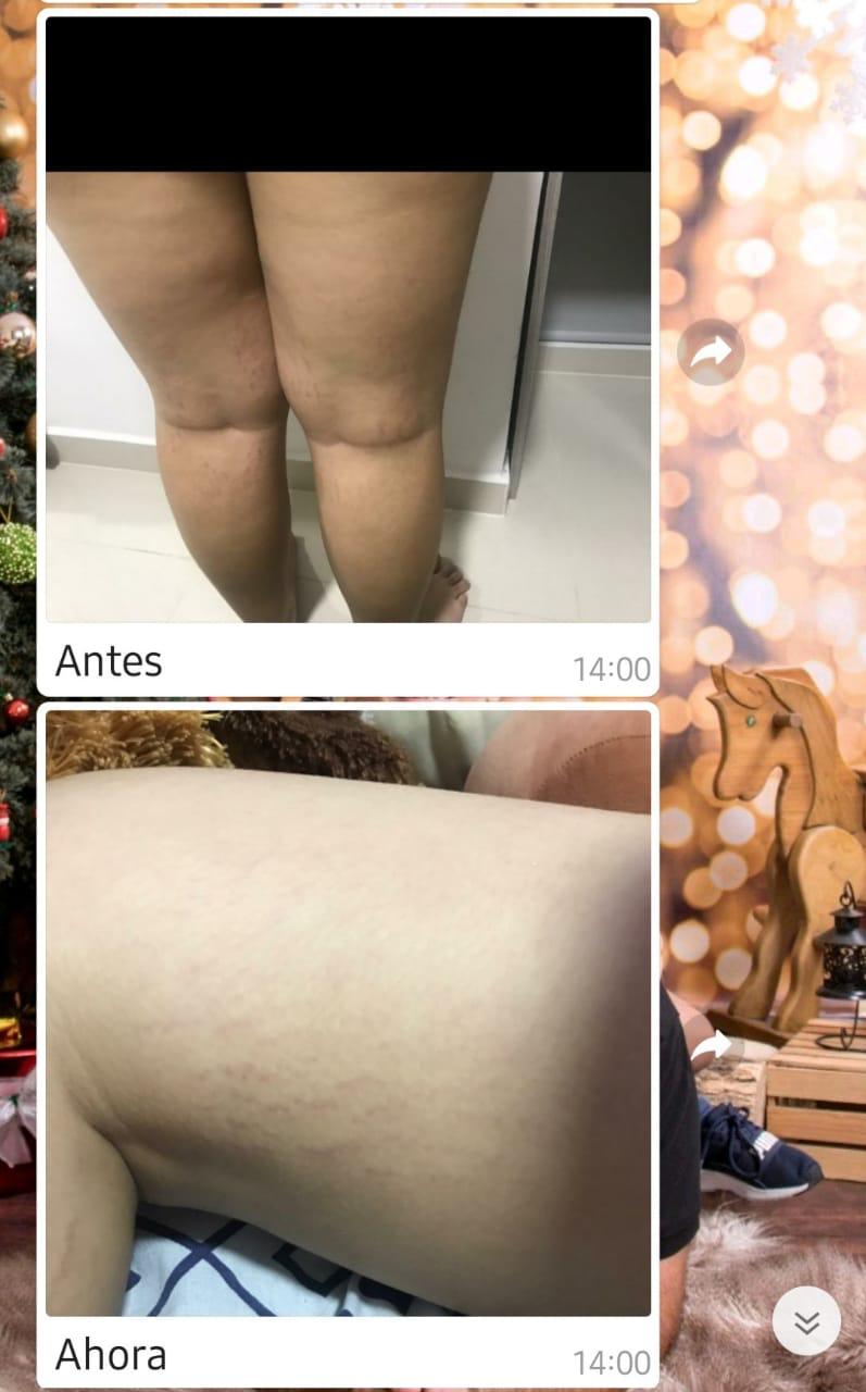 Miniatura 14 de GEL CORPS